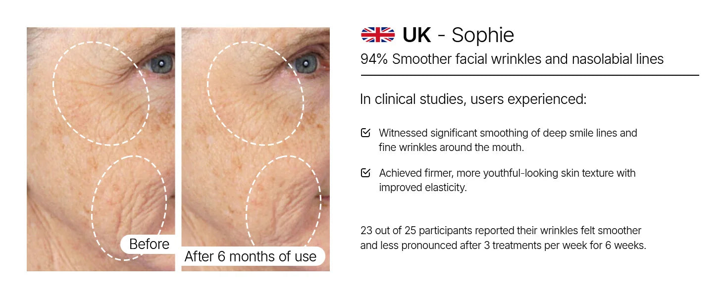 Face L6 510K Red Light and infrared Therapy SPA