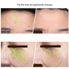 EMS Facial Body Radio Frequency Machine Skin