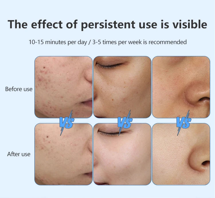 8 Colors LED Face Mask with Neck Near Infrared