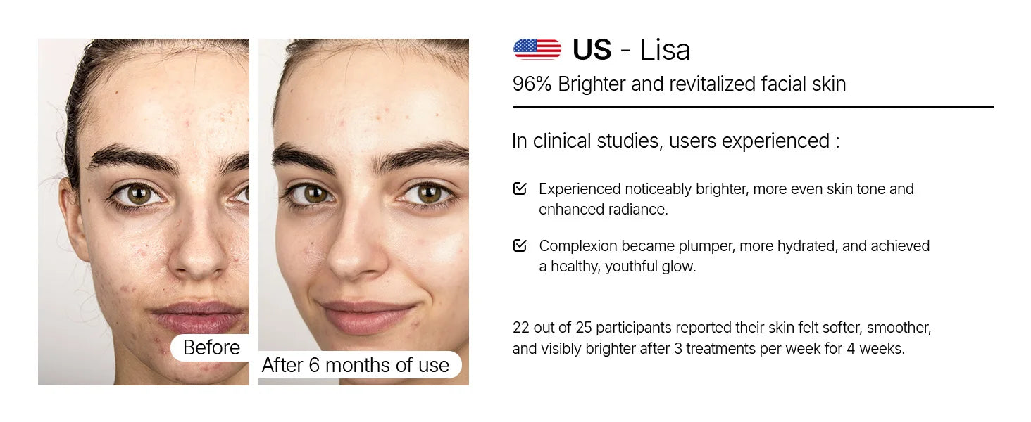 Face L6 510K Red Light and infrared Therapy SPA